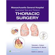 Massachusetts General Hospital Illustrated Tips and Tricks in Thoracic Surgery: Print + eBook with Multimedia 9781975171933