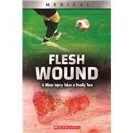 Flesh Wound: A Minor Injury Takes a Deadly Turn (XBooks) 9780531132968