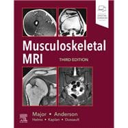 Musculoskeletal MRI 9780323415606
