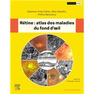 Rétine : atlas des maladies du fond d'oeil 9782294785665