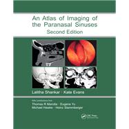 Book cover for Atlas of Imaging of the Paranasal Sinuses
