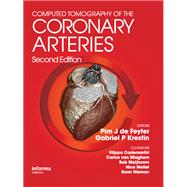 Book cover for Computed Tomography of the Coronary Arteries
