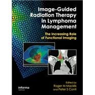 Book cover for Image-guided Radiation Therapy in Lymphoma Management
