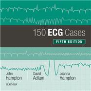 Book cover for 150 ECG Cases