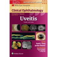 Book cover for Uveitis
