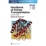 Book cover for Handbook of Kidney Transplantation