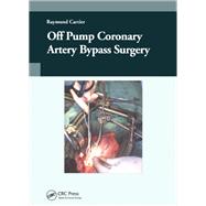 Book cover for Off-pump Coronary Artery Bypass Surgery