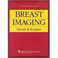 Book cover for Breast Imaging