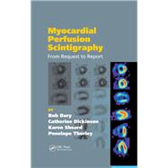 Book cover for Myocardial Perfusion Scintigraphy