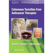 Book cover for Cutaneous Toxicities from Anticancer Therapies