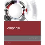 Book cover for Alopecia