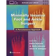 Book cover for Minimally Invasive Foot and Ankle Surgery A Percutaneous Approach